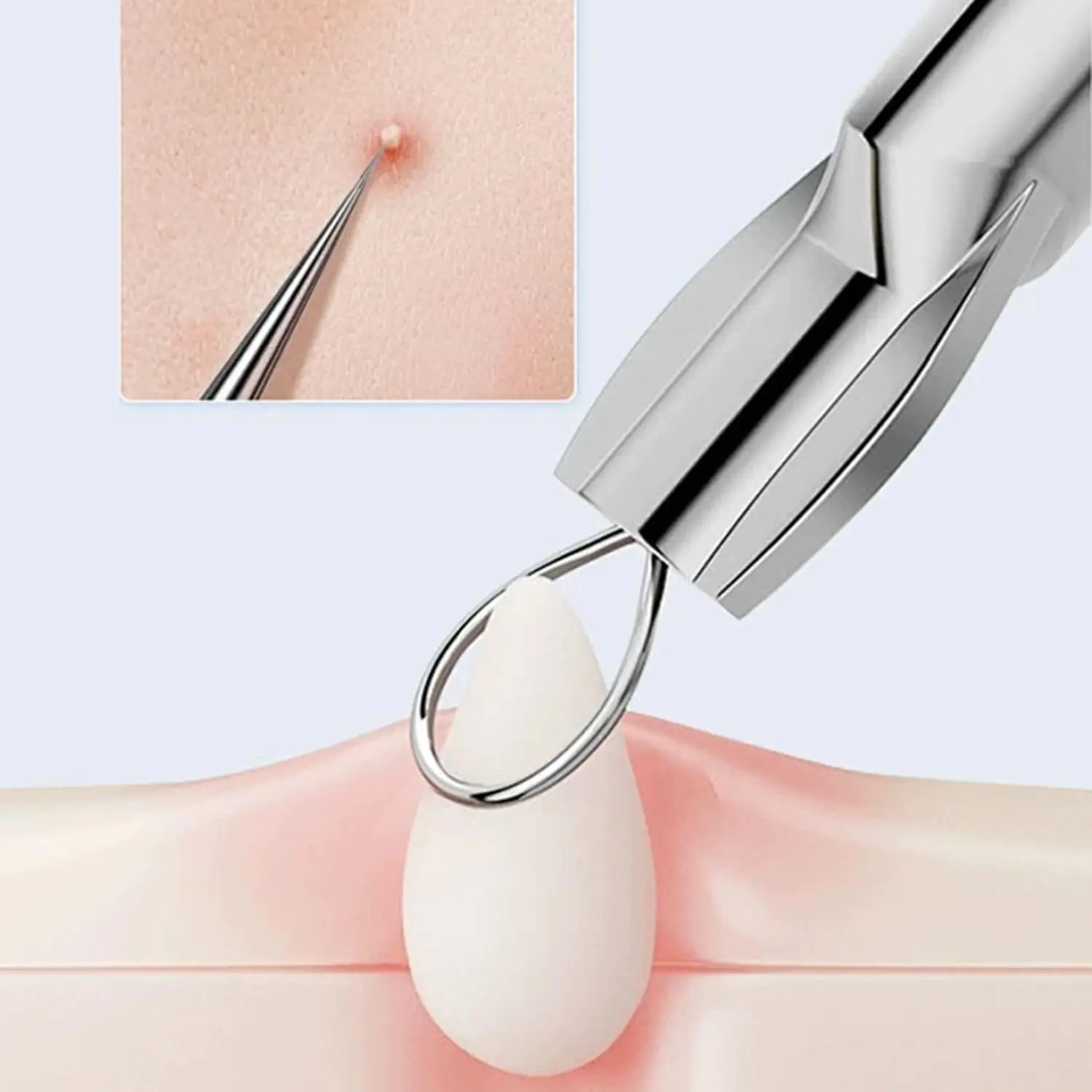 removedor-de-cravos-em-aco-inoxidavel-ferramentas-de-extracao-de-acne-limpeza-profunda-para-todos-os-tipos-de-pele