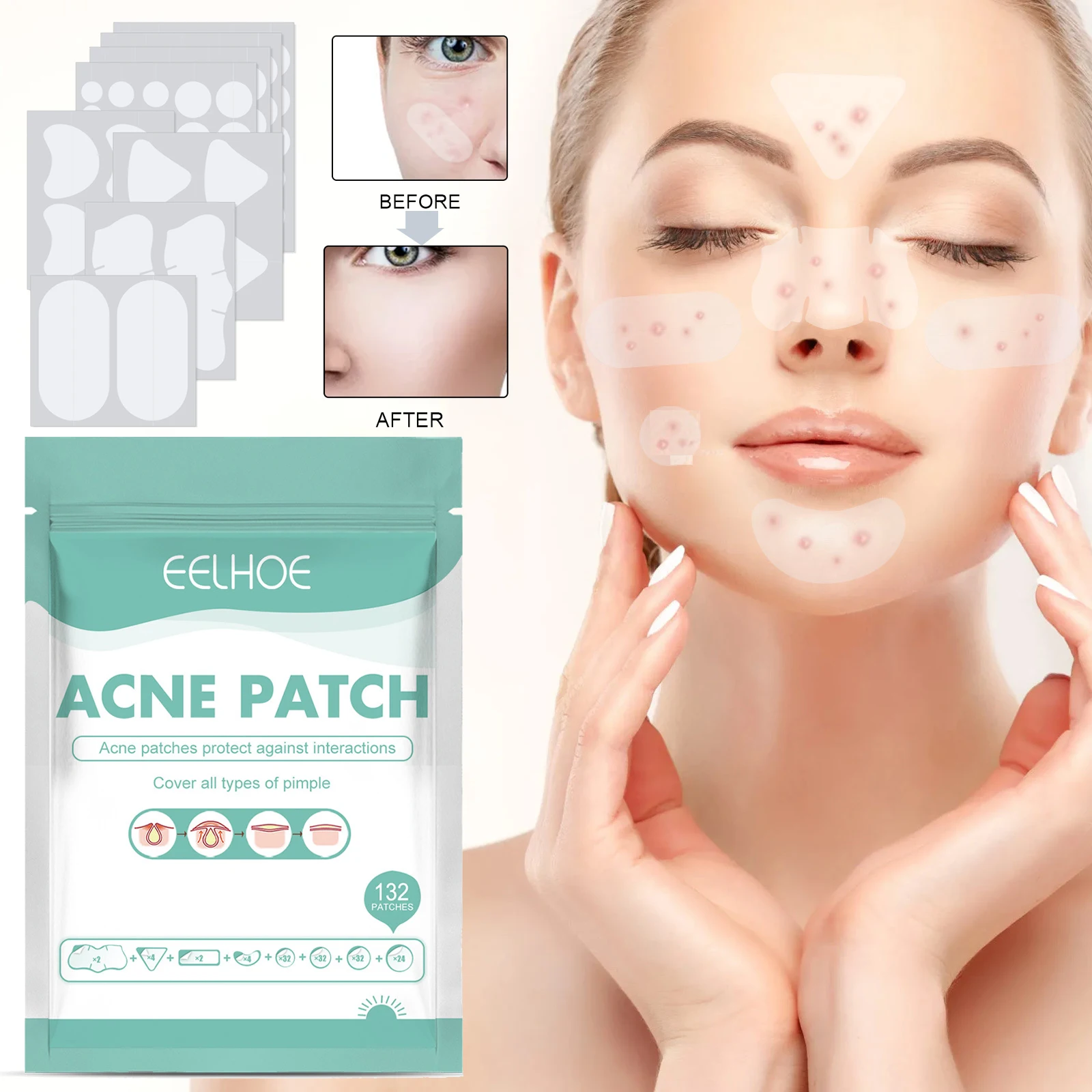 132Pcs Invisible Removal Pimple Anti-Acne Hydrocolloid Patches Spots Marks Concealer Waterproof Repair Sticker