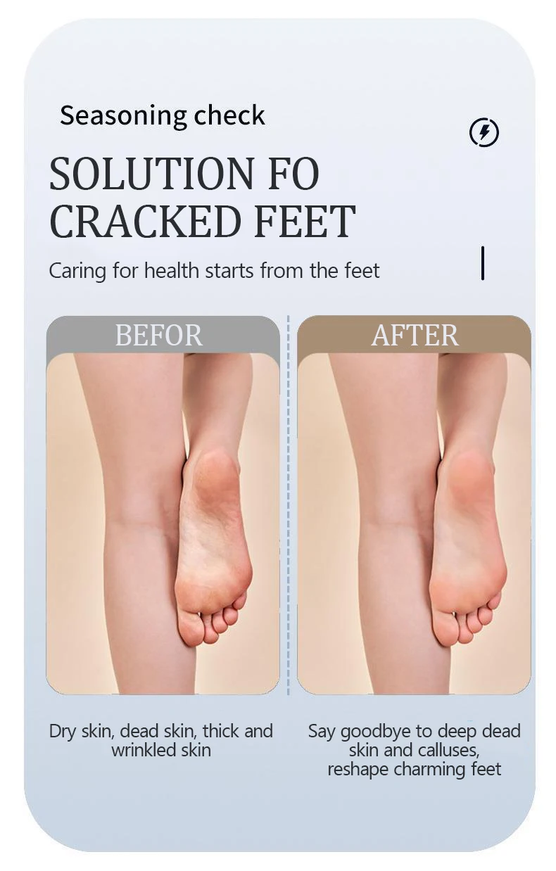 Waterproof Charged Electric Foot File for Heels Grinding Pedicure Tools Professional Foot Care Tool Dead Hard Skin Callus USB