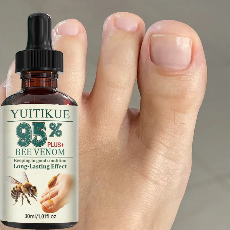 YUITIKUE 95% Plus Bee Venom Nail Care Essence 30ml 3 Days Fast Repair Strengthen Brittle Fingernails Toenails Soften Cuticle Oil