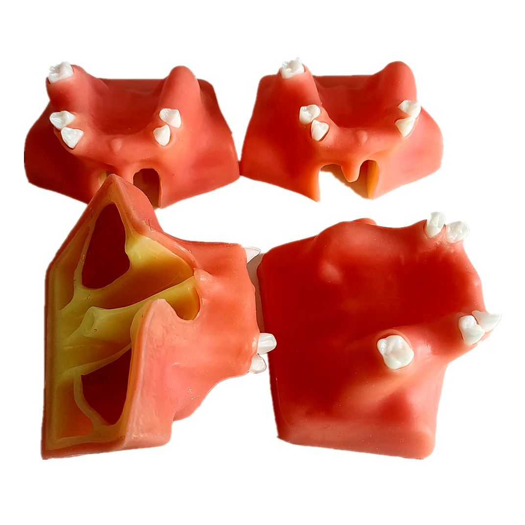 Modello di pratica dentale modello di sollevamento mascellare allenamento dell'impianto di sollevamento del seno superiore