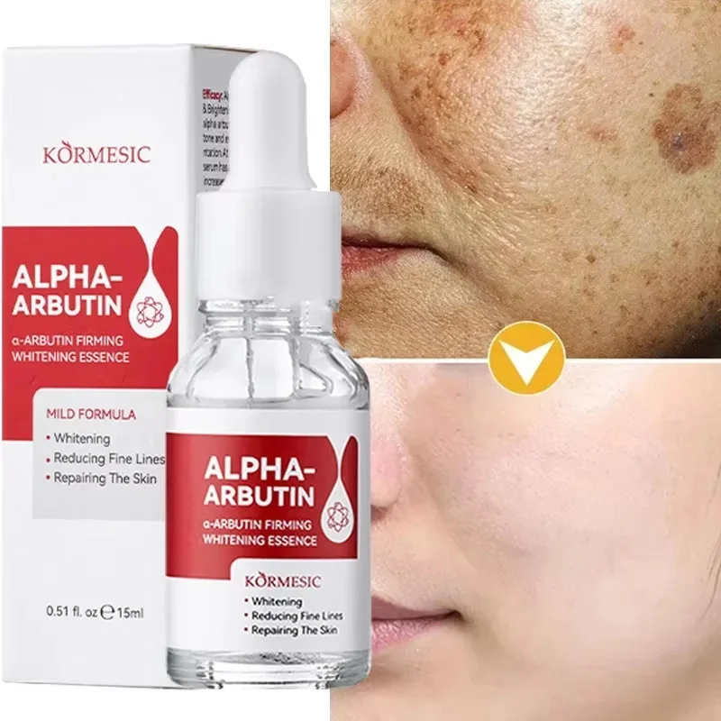 

Powerful Dark Spots Remover Whitening Serum Face Freckle Melanin Correcting Anti Pigmentation Brighten Skin Beauty Care Essence