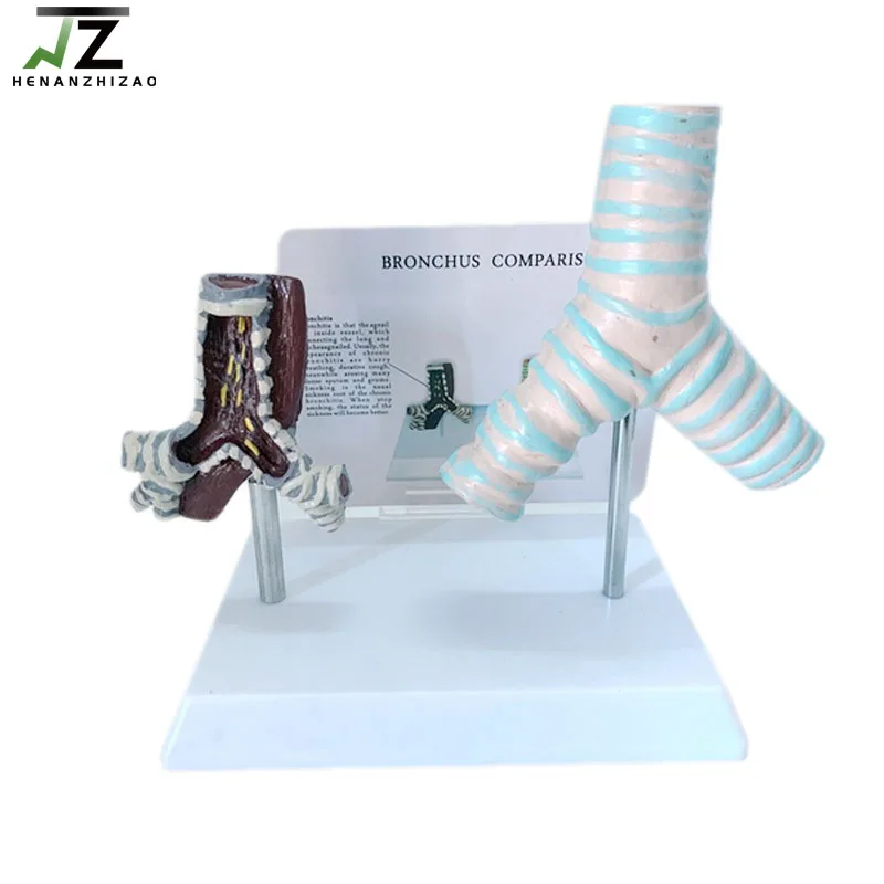 

Comparison of Healthy and Smoking Pathological Trachea Anatomy Respiratory System Model