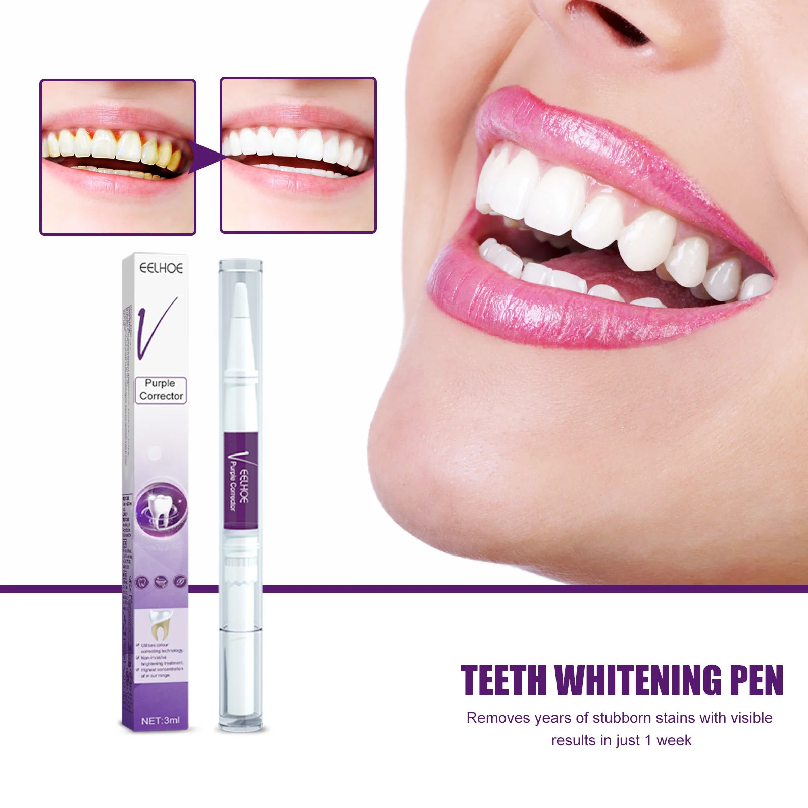 V34 Purple Teeth Cleaning Gel Pen Teeth Color Corrector,Remove Tooth Stain Yellow Teeth Freshen Breath Oral Care Product