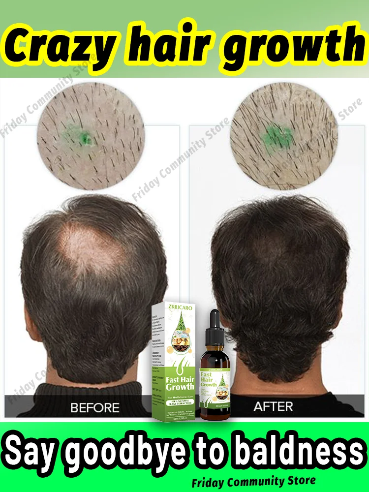 99% of buyers buy again, have more and more hair, say goodbye to baldness, thick hair,Hot selling product