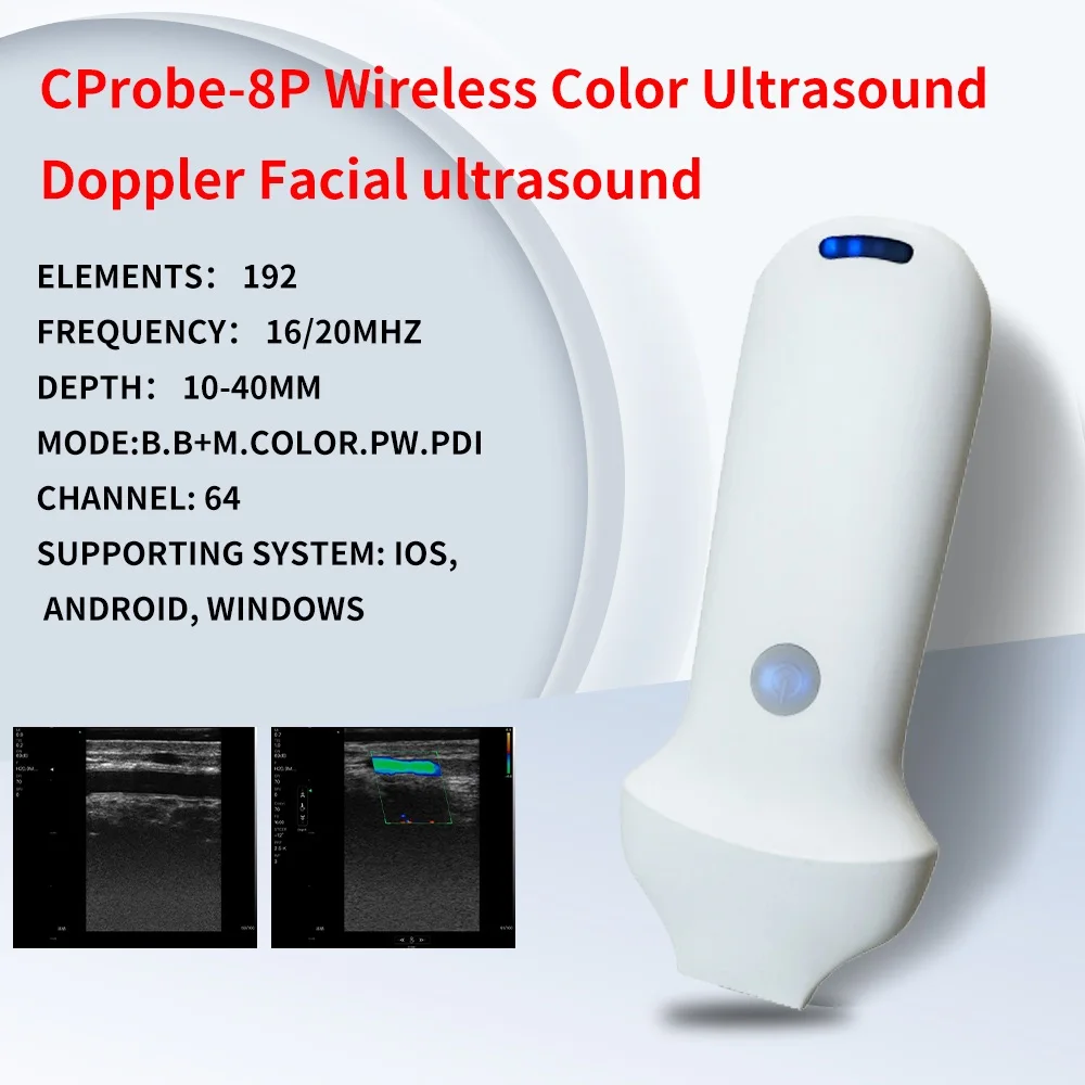 192 Elements 18/24Mhz Frequency Wireless Color Ultrasound Scanner Portable Medical Machine Support IOS Android Windows