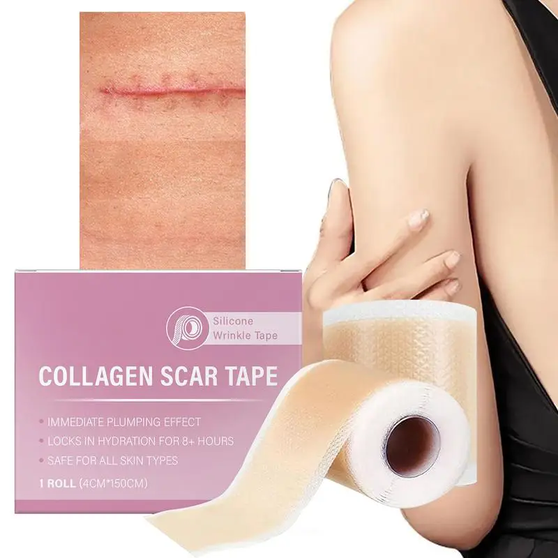 1 rollo de hojas de silicona para cicatrices, cinta autoadhesiva para cubrir cicatrices de 4cm x 150cm, tiras reutilizables y efectivas para el cuidado de la piel, cinta para cicatrices de colágeno
