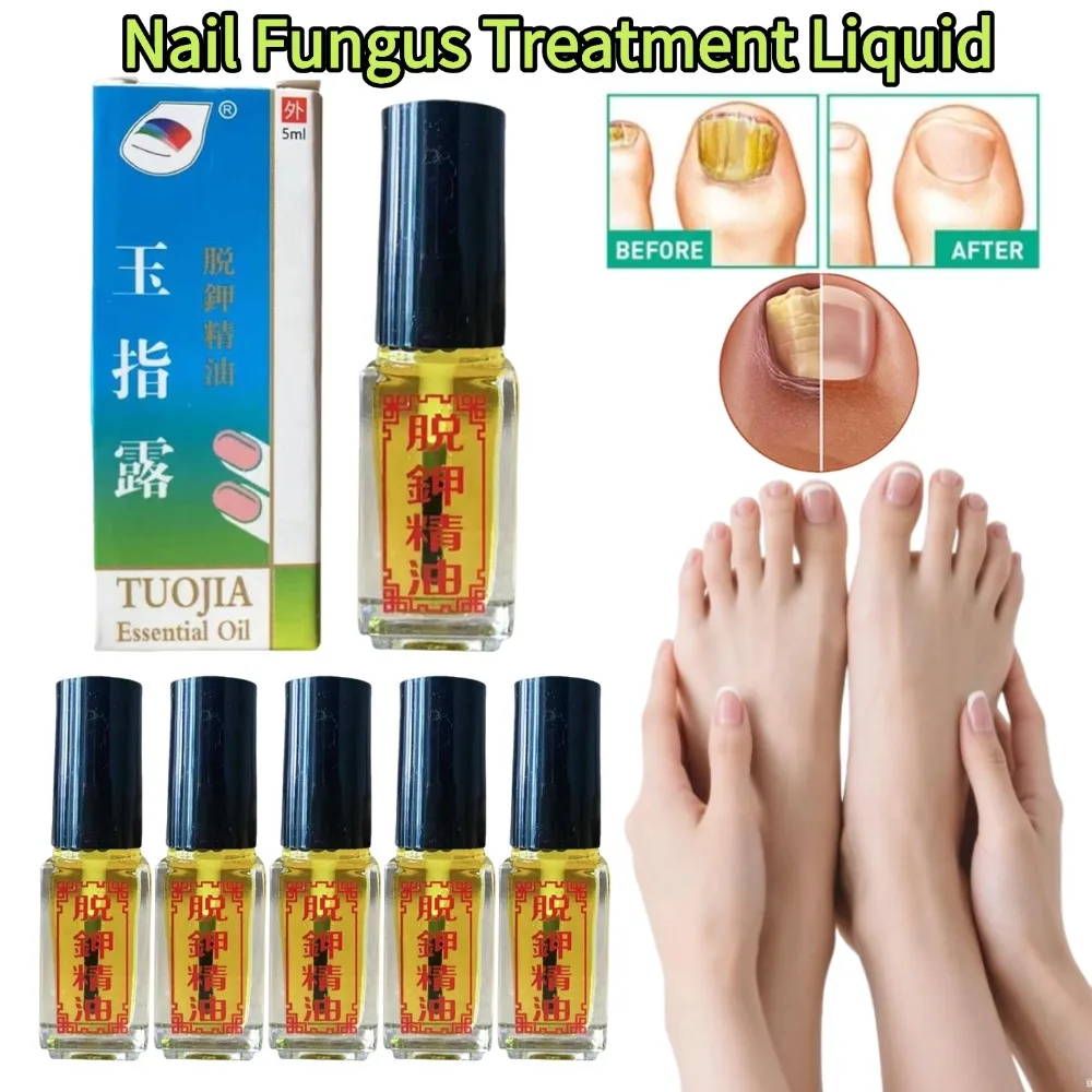 3Days Effect Nail Fungus Treatment Liquid Fungal Nail Removal Toenail Fungus Oil Anti Infection Repair Care Nail Bright GrowNail