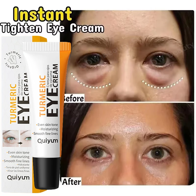 

Instant Eye Bag Removal Cream Turmeric Anti-Wrinkle Firming Skin Fade Fine Lines Anti Dark Circle Puffiness Brightening Eye Care