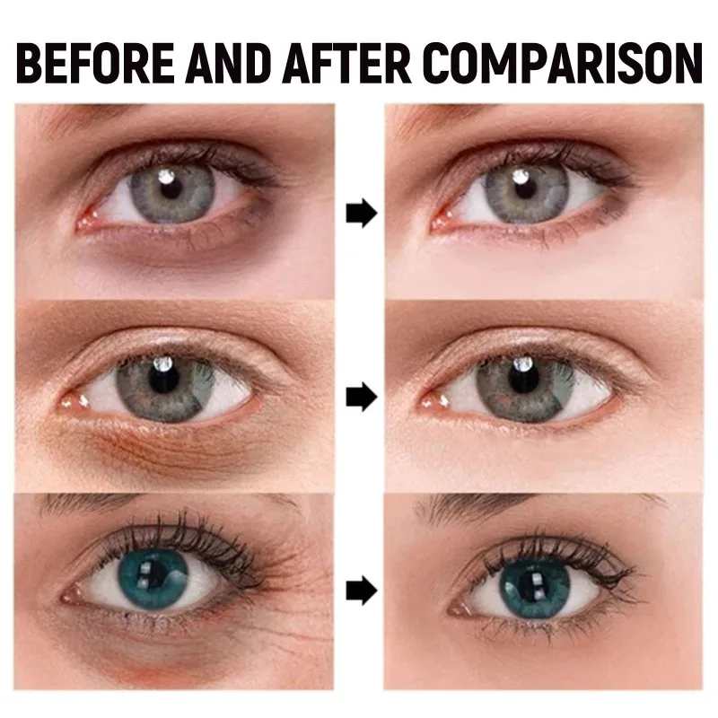 Anti Dark Circles Eye Bags Serum Instant Remove Wrinkles Eye Cream Improve Puffiness Fade Eye Fine Line Cream Tighten Skin Care