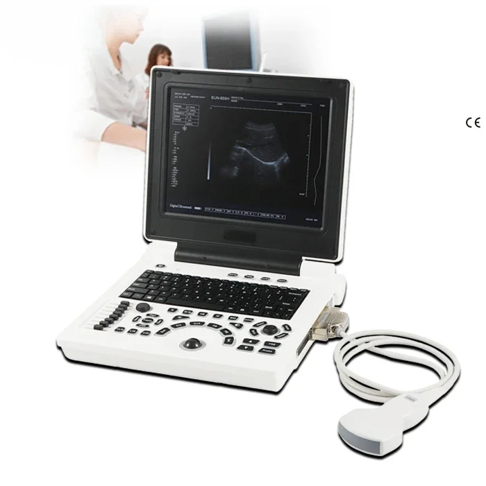 

Laptop BW human clear baby images 12.1" color 2D BW screen Ultrasound scanner machine