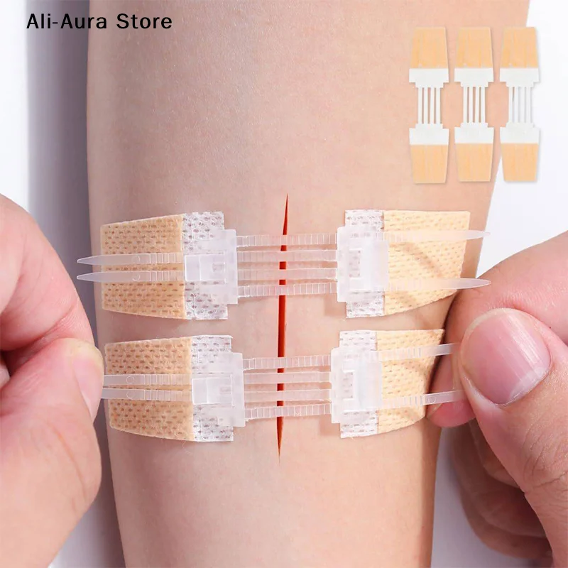Zipper Band Aid Painless Wound Closure Patch Sutureless Quick  Medical Bandage For Travel Hiking Sporting Events
