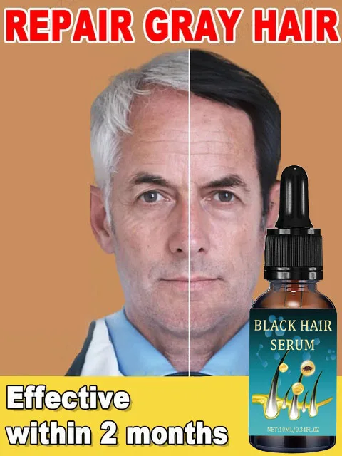 

White Hair Care White hairs essence Natural Anti Gray Hairs Serum - Repair White & Darkening Hair| Nourishing Hair Care Remedy