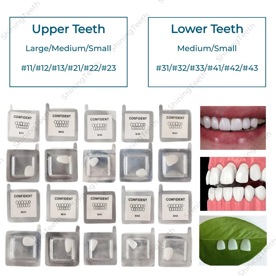 

Dental Composite Porcelain Veneers Teeth Whitening Resin Crown Veneer 30Sizes