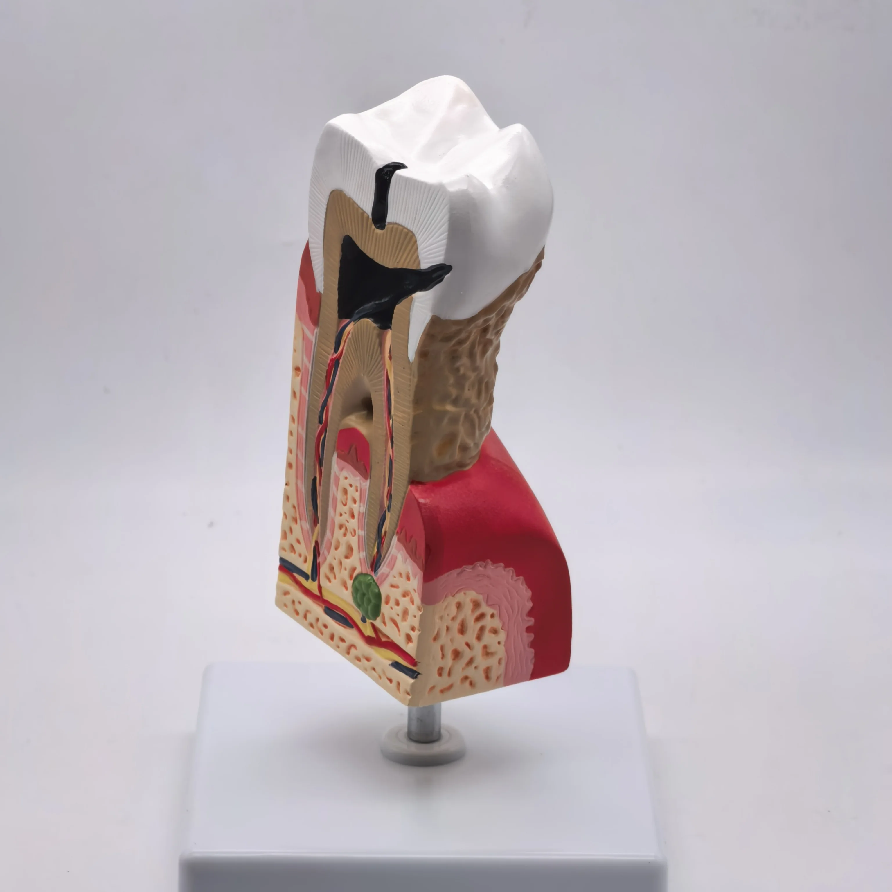 Anatomia médica do modelo anatômico dos dentes malezas humanos do PVC para a educação do paciente