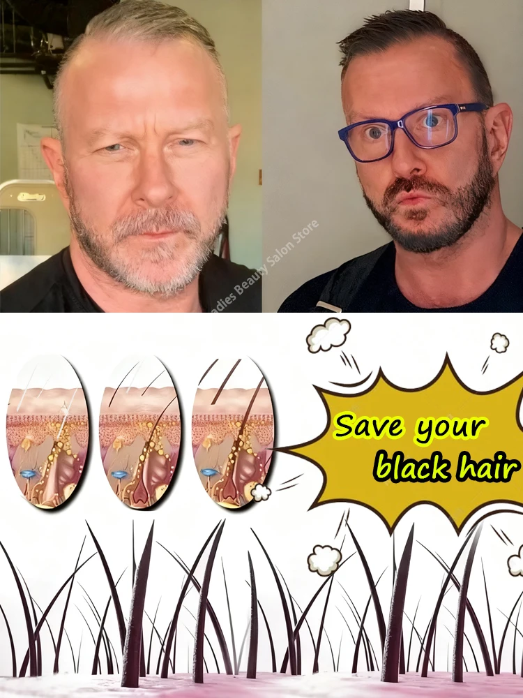

Restore your beautiful black hair in 7 days; unisex hair loss prevention and care product. Regain your beauty and handsomeness.