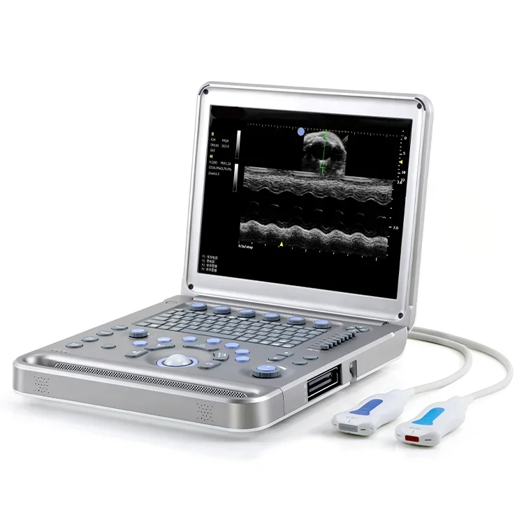 ultrasound scanner system ultrasound machine doppler medical ultrasound instruments for hospit