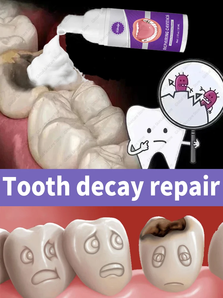 

Teeth Decay repair