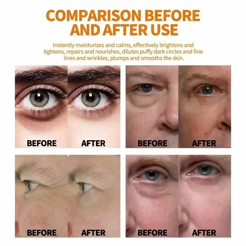 Vitamin E-Augentaschen-Entfernungscreme, Vitamin B5, Anti-Falten, straffende Haut, verblasst feine Linien, Anti-Dunkle-Kreis-Schwellungen, erhellt das Auge, Auto