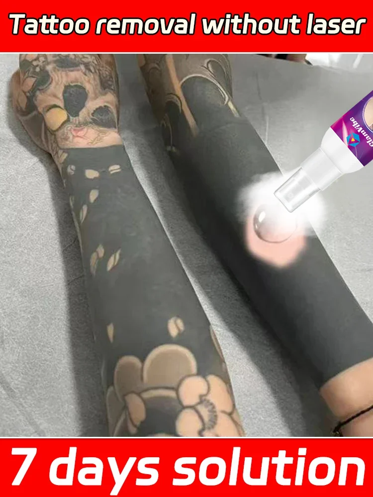 

Tattoo removal spray, no laser required, easy to make tattoos disappear
