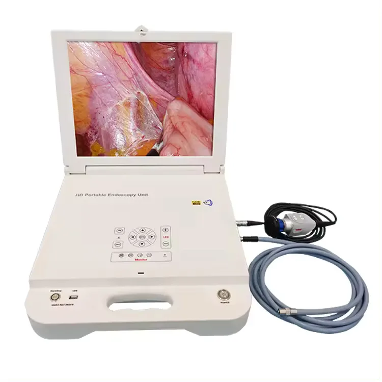 High Quality Rigid Nasopharyngoscope Full Hd Endoscope System Otolaryngology With Cold Light Source