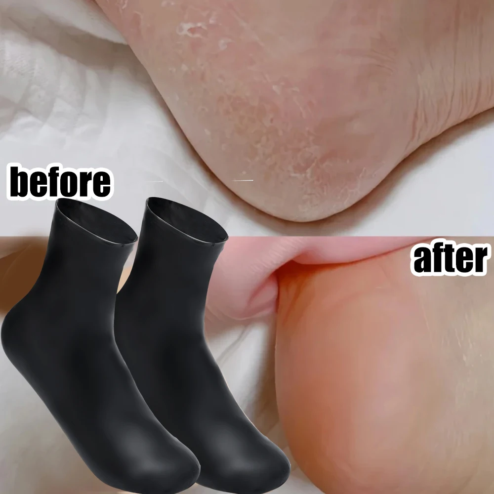 확장 실리콘 발 양말, 모이스처라이징 풋 케어 양말, 각질 마사지, 모이스처라이징 스파, 페디큐어 젤 양말, 발 도구