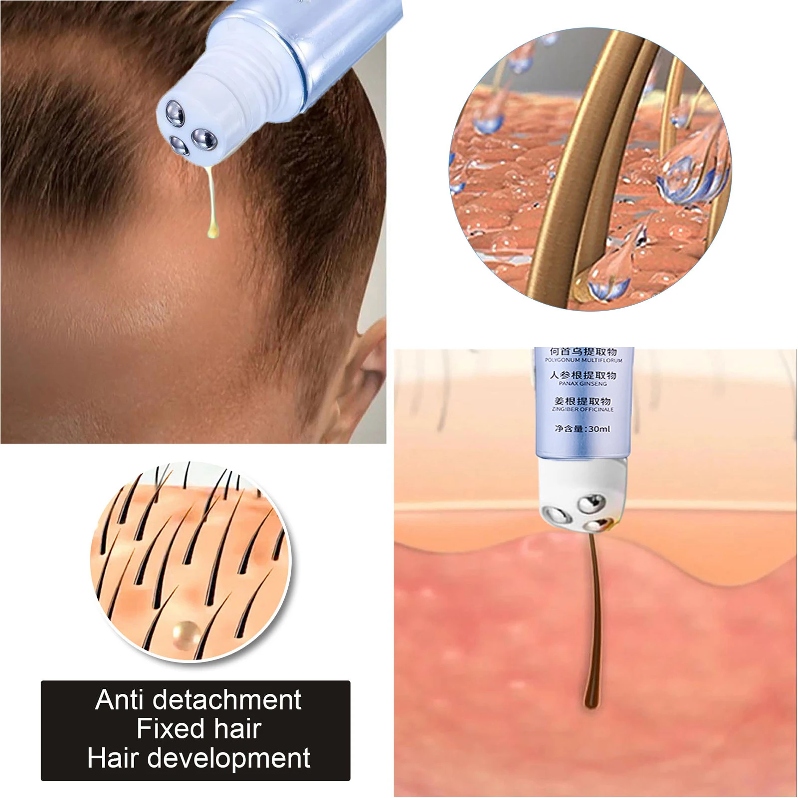 Имбирный массажный ролик для роста волос, сыворотка против выпадения волос, питающая кожу головы, активирует фолликулы, предотвращает облысение, плот укрепляет волосы