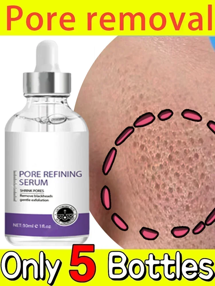 

Repair Large Pores Serum Firms Skin Fines Pores Improves Dullness Brightens Skin Facial Beauty Care