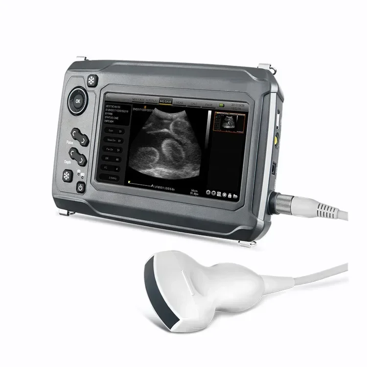 Handheld Full Digital Farm Veterinary Clinic Ultrasound Scanner Pregnancy Veterinary Ultrasound Machine