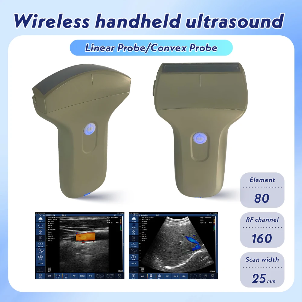 80E Full Digital Ultrasound Imaging Diagnostic Instrument Convex Array / Linear Array Color Ultrasound