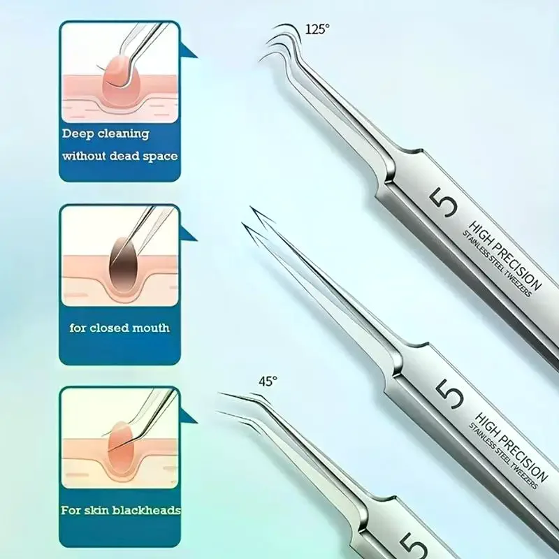 3Pcs Set Stainless Steel Blackhead Removal Tweezers With A Plastic Box High Precision And Durability Blackhead Removal Tweezers