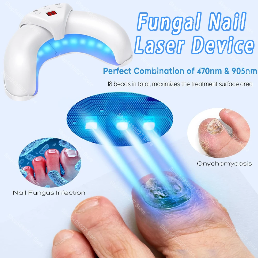 Nail Fungus Laser Treatment Device Professional Onychomycosis Therapy Cure Machine for Broken Cracked Split and Weak Nails