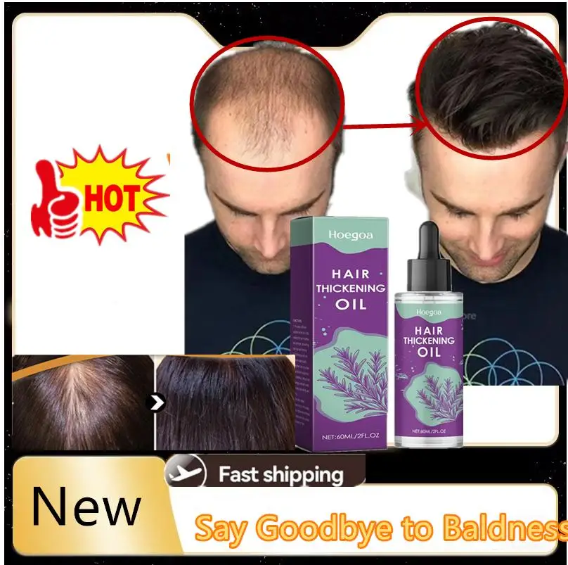 

New Powerful Serum Spray Repair Hair Nourish Root Regrowth Hair Anti Hair Loss Essence Men Women Hair Care Products