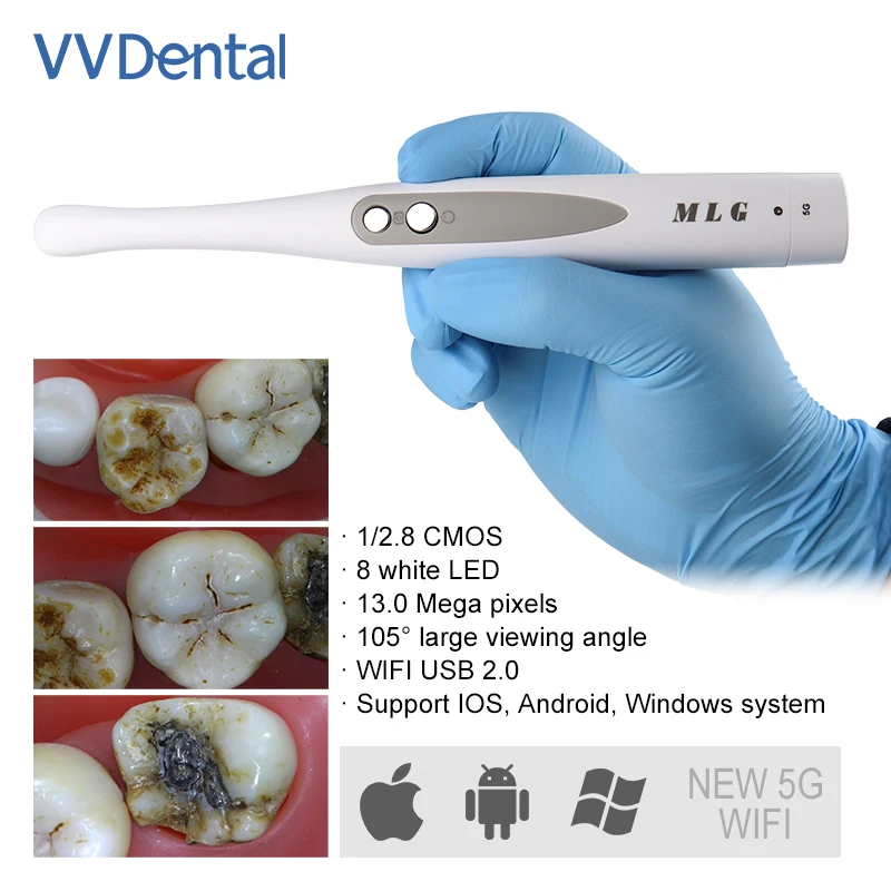 

VVDental Wireless Oral Endoscope Intraoral Camera w/ Wifi IPX5 Waterproof & Ultra HD 1300W Pixel for IOS/Windows/Android System