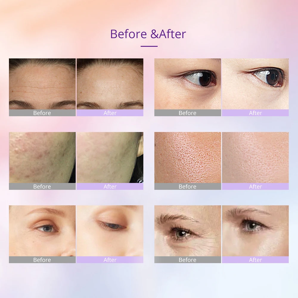 Máquina de lifting facial 7 cores, rejuvenescimento da pele, dispositivo de beleza, uso doméstico, massageador facial