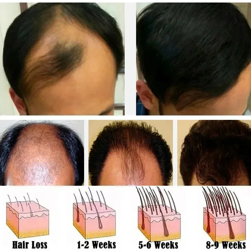 

Спрей для роста волос с биотином, корни, против выпадения волос, сыворотка для восстановления роста волос, восстановление поврежденной кожи головы, питательные средства по уходу для женщин и мужчин