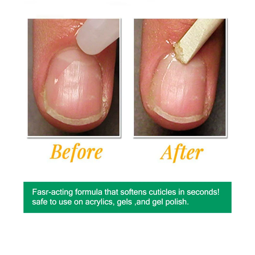 KODIES GEL dissolvant de cuticules instantané huile liquide adoucisseur de cuticules pour les ongles soins des ongles avec lanoline pied peau morte manucure pédicure