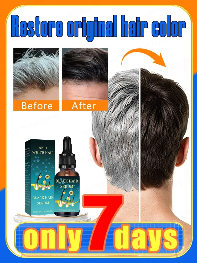 

Natural Anti-Grey Hair Essence Serum No hair color,no allergies Anti-grey hair essence Serum Remedy Healthy