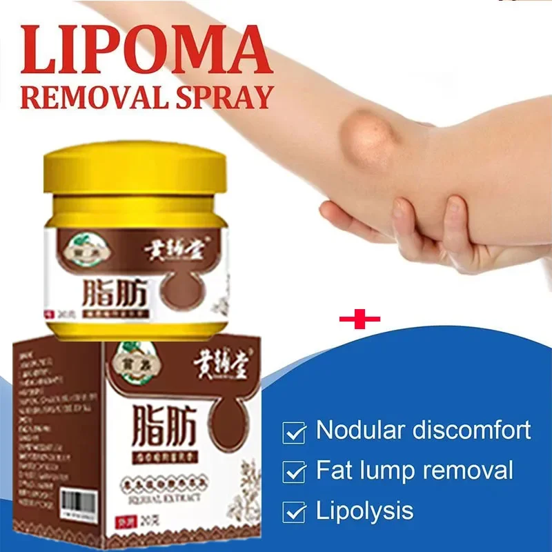 Crema calmante para eliminación de lipomas, alivio del dolor de forma segura, crema subcutánea para eliminar grumos de grasa, celulitis