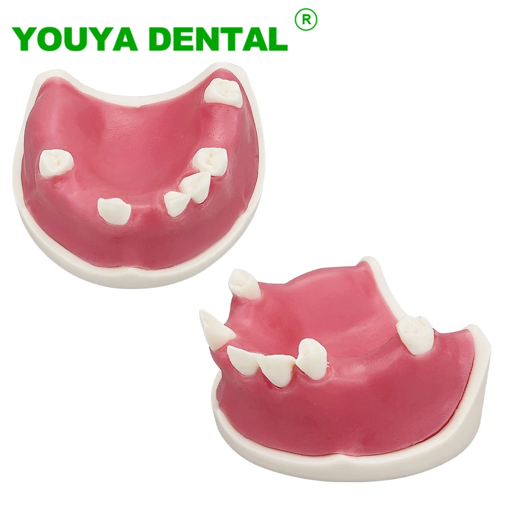 Dental Implant Training Model Soft Gum Teeth Practice Typodont With Missing Teeth Dentistry Studying Teaching Demonstration Tool