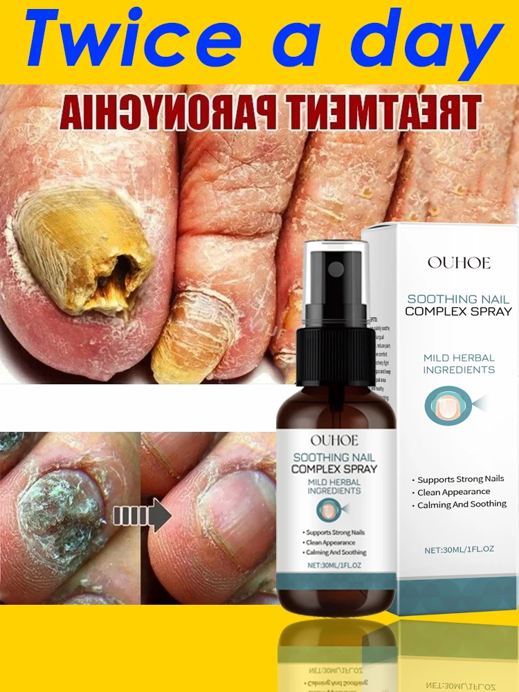 

Fungal Nail Spray Foot Nail Fungus Removal Anti Infection Paronychia Onychomycosis Foot Nails Care