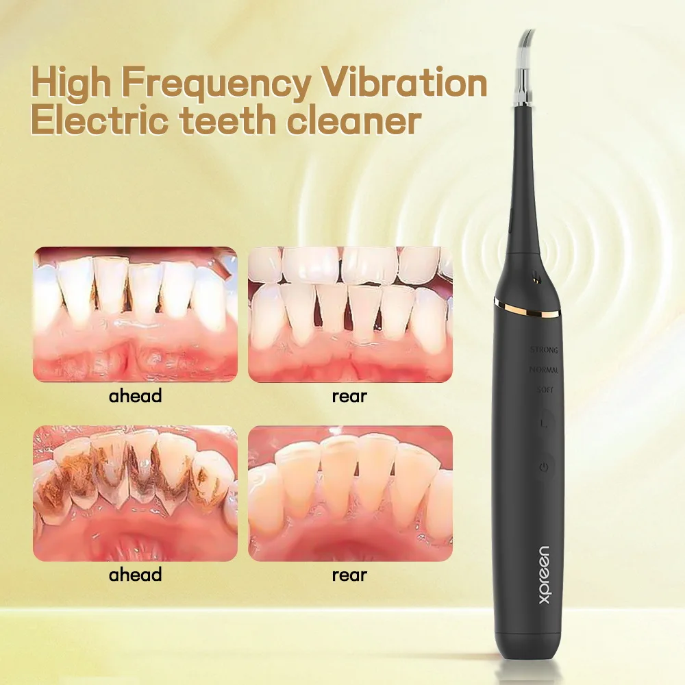 Интеллектуальный электрический звуковой волновой очиститель зубов, высокочастотная вибрация, удаление пожелтения, пятен, зубного камня и зубного камня