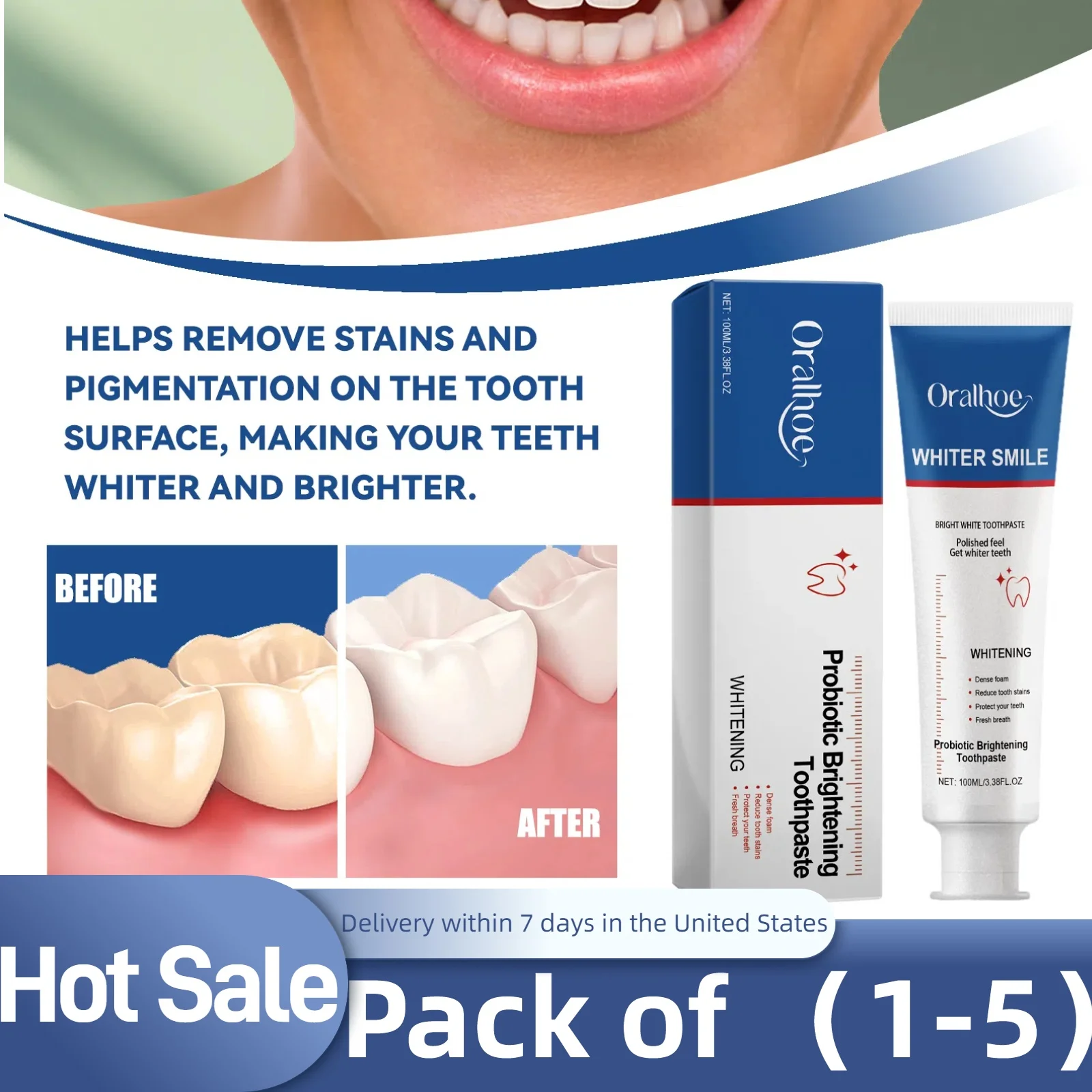 Probiotic Toothpaste Brightens Teeth, Removes Yellow Teeth and Stains, Tooth Cleaner, Oral Hygiene, Cleans and Freshens Breath