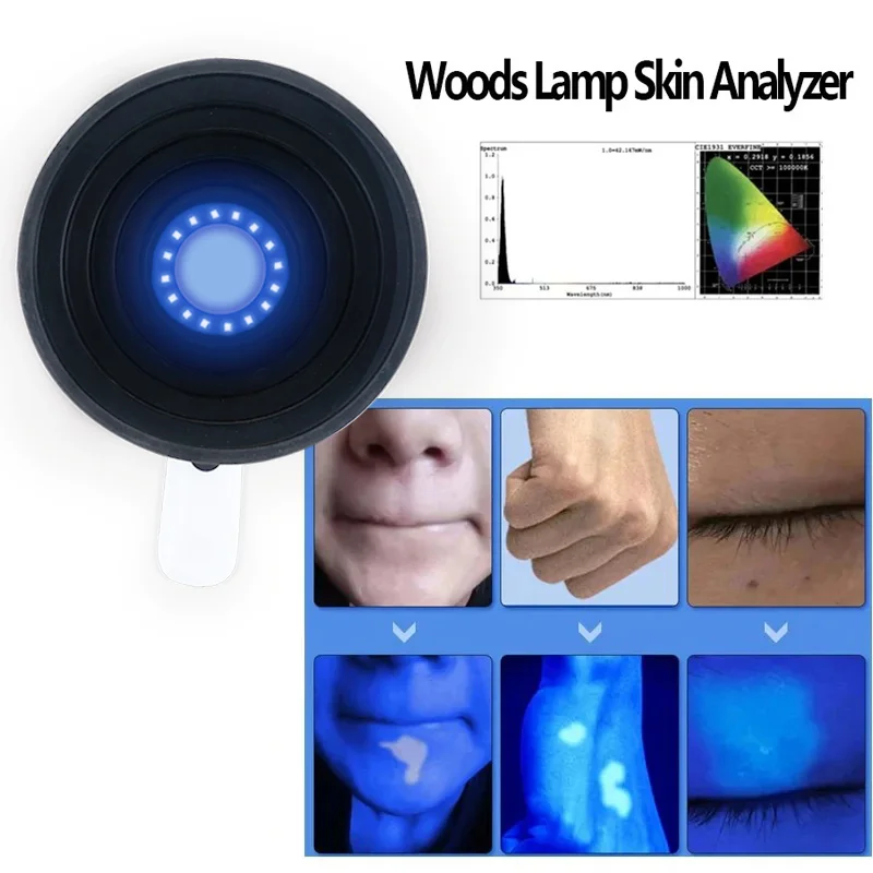 Wood Skin Lamp Analysis Machine for Skin Analyzer Professional Lamp Skin UV Analyzer Wood Lamp Facial Skin Test Machine