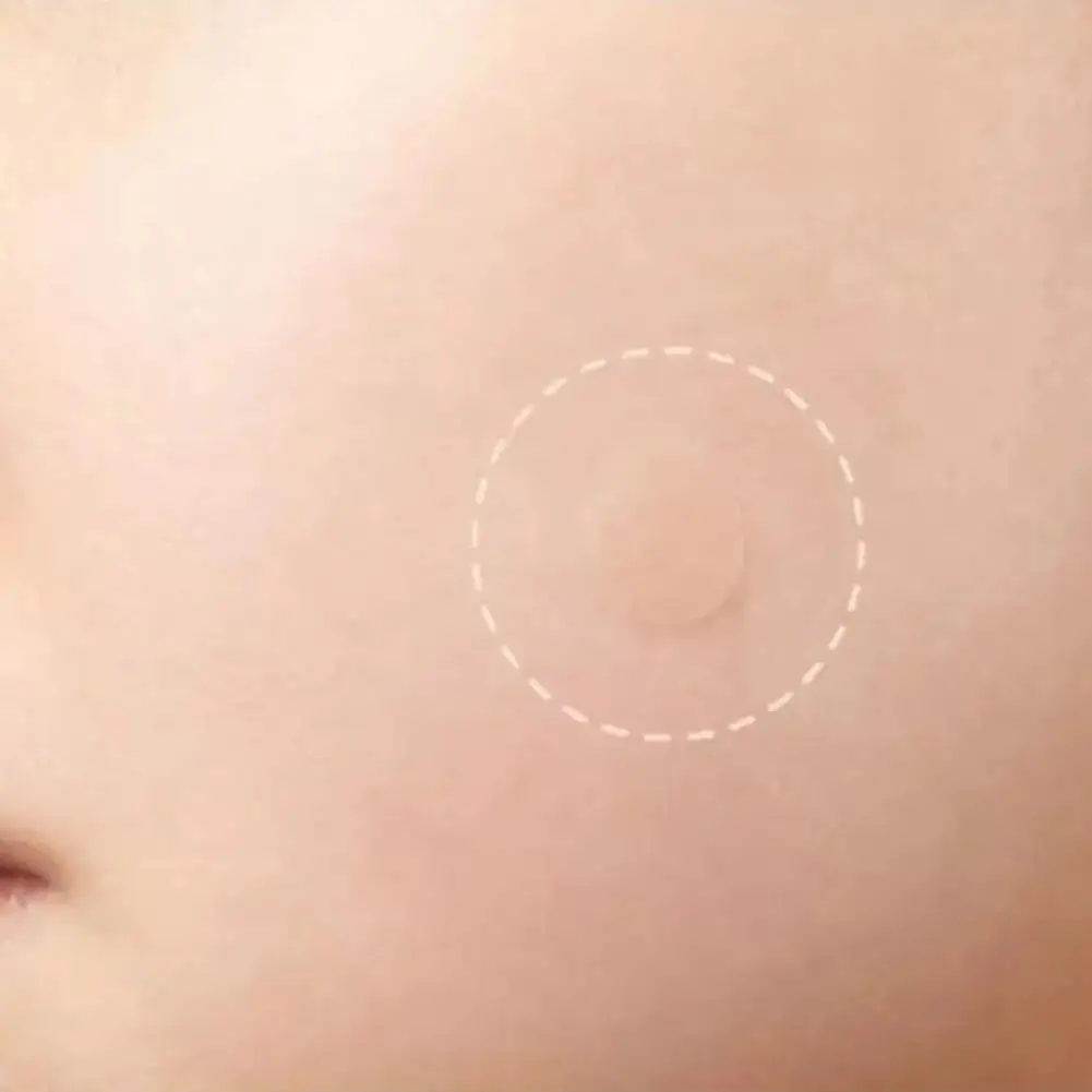 36Pcs Tea Tree Essential Oil Skin-Tone Round Acne Patches Hydrocolloid Technology Gently Heals Blemishes Gentle Invisible Cover