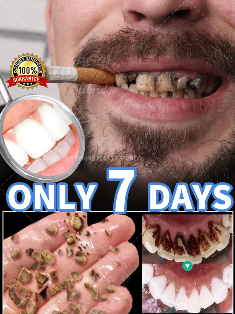 

Hot selling Tartar removers dissolve tartar and remove stains