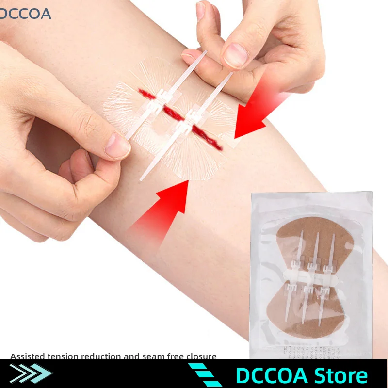 Zipper Band-aid Painless Wound Closure Device Suture-free Wound Dressing Patches Zip Suture Reducer Band Aid