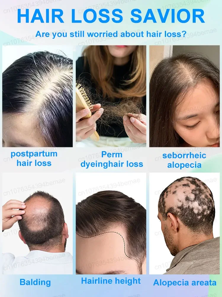 Serum pertumbuhan rambut dengan adenosine esensi solusi minyak produk pengaktif pengobatan cepat kebotakan alopecia herediter dan seboroik