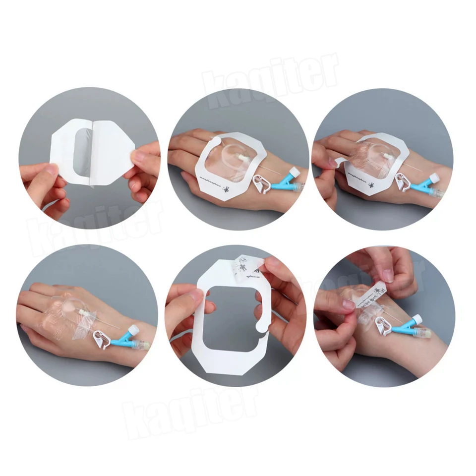 10-20 قطعة 6X7cm IV قنية ثابتة طبقة شفافة خلع الملابس مقاوم للماء الجرح ضمادة بقع لاصقة بعد الجراحة لا معقمة #3