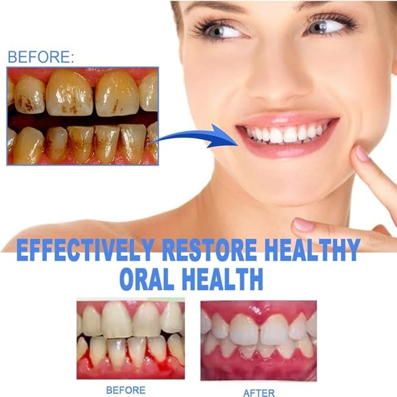 2-Pack Dental Repair Gel Relieves Inflamed Gums And Reduces Bad Breath Deep Clean Tooth Dirt Care Gums Fresh Breath Care Gel